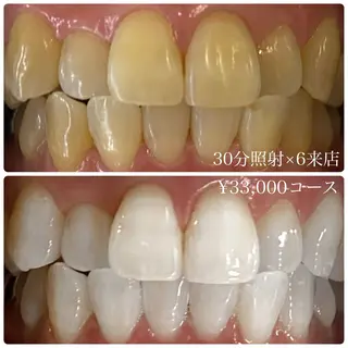 メンズ ホワイトニングルーム　川崎店所属・ホワイトニング ルーム　川崎店のその他イメージ