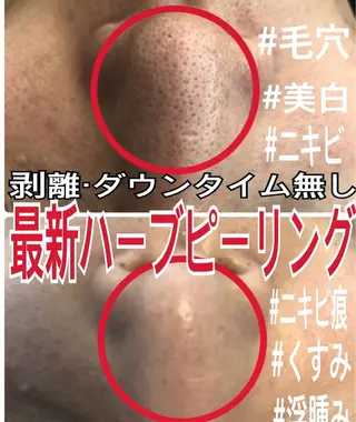 LILIANA所属・LILIANA ☆YURIのエステ・リラクイメージ