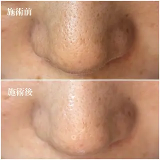 毛穴専門店アイミュー mamiのエステ・リラクイメージ