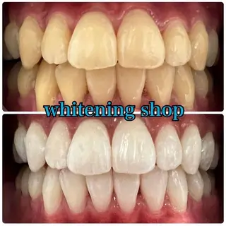 ホワイトニング ショップ吉祥寺店のエステ・リラクイメージ