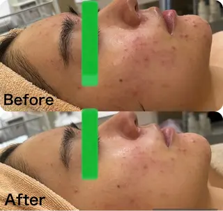 小顔&美肌品川店 Masqueradeのエステ・リラクイメージ