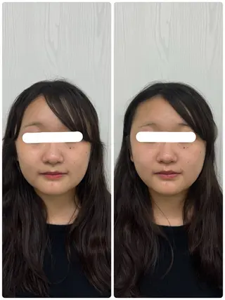 美容鍼×小顔矯正 ×美容整体　浜川泰仁のエステ・リラクイメージ