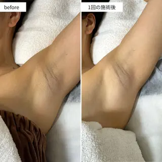 なにわのシミ取り職人 YUKIのエステ・リラクイメージ