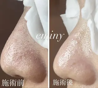 EMINY （エステティシャン）のエステ・リラクイメージ