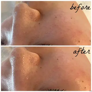 メンズ メナード岐阜市茜部 杉浦のエステ・リラクイメージ