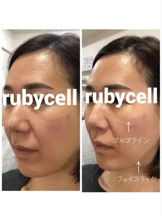 ruby cell hue.のその他イメージ