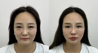 ネイル aliaハイフ&水光ジェットサロン所属・aliaハーブ水光店 エステティシャン募集のエステ・リラクイメージ