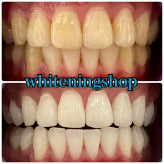 ホワイトニング ショップ吉祥寺店のエステ・リラクイメージ