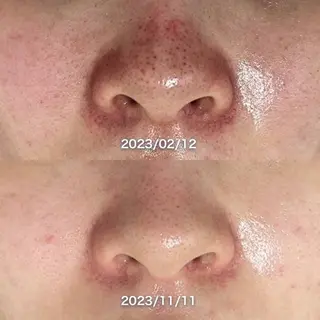 韓国美肌/肌質改善 【天神】yuiのエステ・リラクイメージ