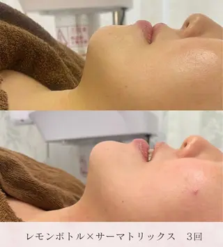 毛穴レス美肌へ🌿 看護師Abe🌼のエステ・リラクイメージ