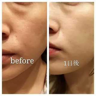 🅖🅤🅩🅔🅛 salonのエステ・リラクイメージ