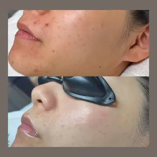 愛維美水光美肌専門店所属・愛維美水光美肌専門店 メンズレディースokのエステ・リラクイメージ