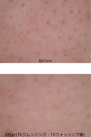 メナードフェイシャルサロン岐阜桜通所属・川田 千絵美のエステ・リラクイメージ