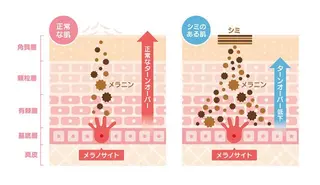 M. lisyelのエステ・リラクイメージ