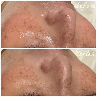 メンズ メナード岐阜市茜部 杉浦のエステ・リラクイメージ