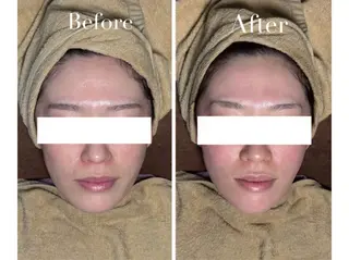 Avenir Brillant所属・松田 紗季のエステ・リラクイメージ