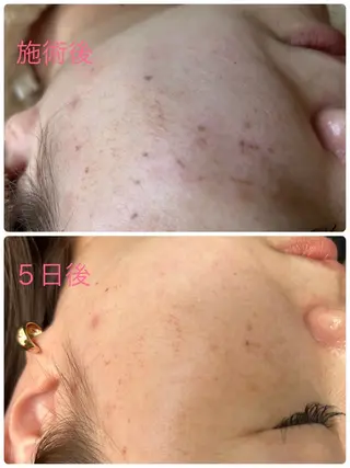 N.style所属・Ｎ. styleのネイルデザイン