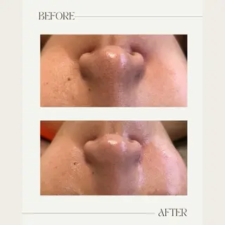 1st｜フェイシャル エステ専門店のエステ・リラクイメージ