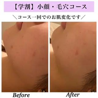 Bellesthe （ベルエステ）のエステ・リラクイメージ