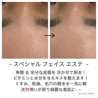 ビューティー ミロワールのエステ・リラクイメージ