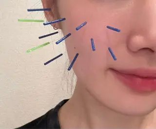 Beauty Salon lau　大山店所属・美容鍼(lau) Maiのエステ・リラクイメージ