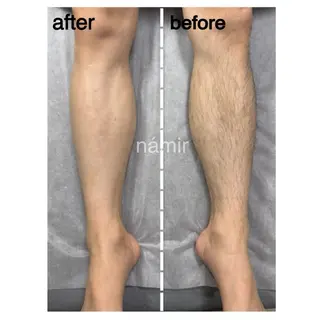 メンズ ブラジリアンワックス＋光脱毛専門店námir【ナミル】所属・ブラジリアンワックス ＆光脱毛námirのエステ・リラクイメージ