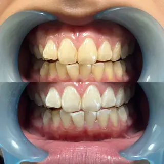 九州オーラルホワイトニング所属・田中 毬亜/薬院警固店のエステ・リラクイメージ