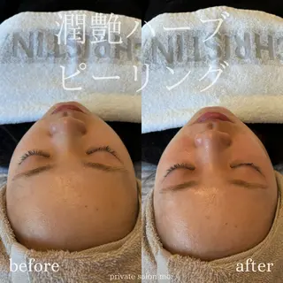 salon moi(モア)のエステ・リラクイメージ