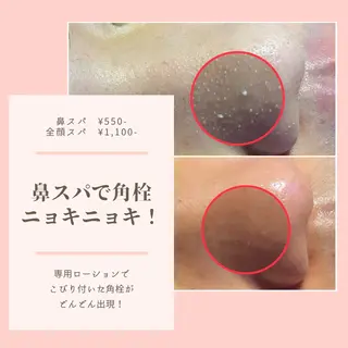 毛穴フェイシャル エステ専門店BBのエステ・リラクイメージ