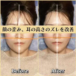 歪み専門💫筋膜整体 はたやまきんま君💪のエステ・リラクイメージ