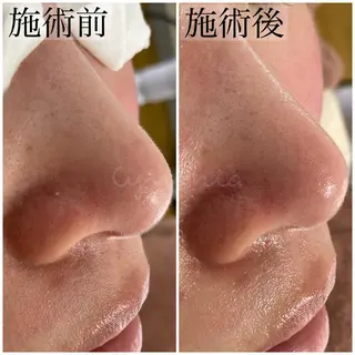 毛穴ケア専門店 Cynthiaのエステ・リラクイメージ