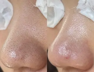 Lipula リプラ所属・毛穴ツヤ肌専門    Lipulaのエステ・リラクイメージ