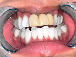 カラー キッズ ネイル パーマ ヘアアレンジ メンズ マツエク・マツパ アイブロウ ロング ライトビューティー 錦糸町店のエステ・リラクイメージ