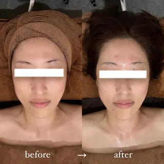 NOEL所属・フェイシャルエステ Utaiのエステ・リラクイメージ