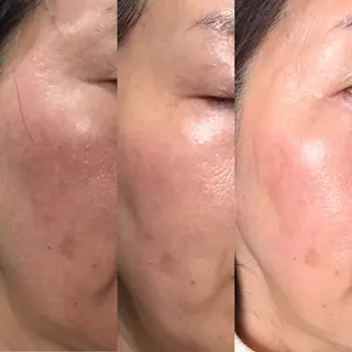 エステティックサロン Liente(リアンテ)所属・Hashimoto .のエステ・リラクイメージ