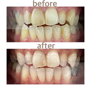 ホワイトニング ショップ船橋店🦷のエステ・リラクイメージ