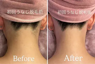 【都度払い脱毛 美肌脱毛】馬車道店のエステ・リラクイメージ