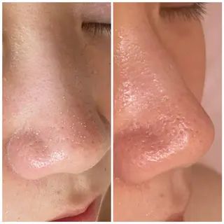 宇都宮エステ　with you所属・福田 厚子のエステ・リラクイメージ