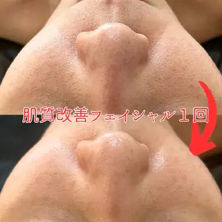 小顔コルギ&肌質改善 の専門店LIBREのエステ・リラクイメージ