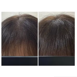 肌質改善Charme coco  増毛のエステ・リラクイメージ