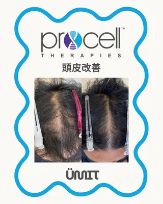 メンズ Ümit（ユミト） プロセルセラピーズのネイルデザイン