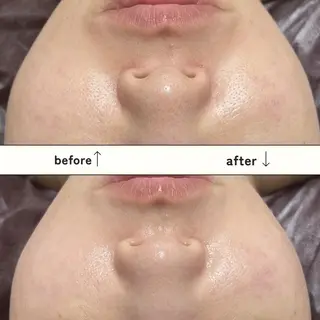 ReN所属・ReN エステサロンのエステ・リラクイメージ