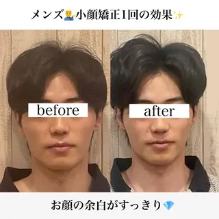 渋谷小顔矯正 毛穴洗浄ウミのエステ・リラクイメージ