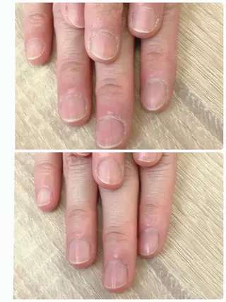 Alluring（アルーリング）所属・Alluring アルーリング中村のエステ・リラクイメージ