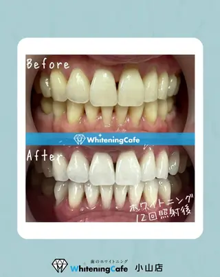 ホワイトニングカフェ 小山店のエステ・リラクイメージ