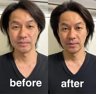 美容鍼灸サロン mahoroba院長のエステ・リラクイメージ