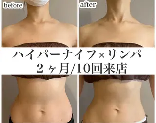 REME/リミー エステサロン東大宮店所属・小林 雪乃のエステ・リラクイメージ