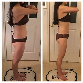 吸い玉痩身専家所属・吸い玉 痩身専家FDLのエステ・リラクイメージ