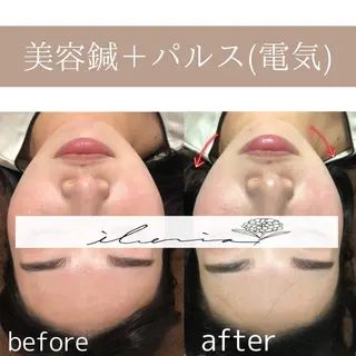 心斎橋痩身ダイエット 韓国.美容鍼.小顔のエステ・リラクイメージ