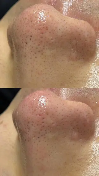 Lilyboo 池袋のエステ・リラクイメージ